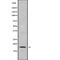 Phospholipase A And Acyltransferase 4 antibody, abx218180, Abbexa, Western Blot image 