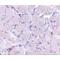 Scavenger Receptor Class B Member 2 antibody, LS-C53322, Lifespan Biosciences, Immunohistochemistry frozen image 