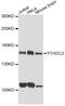 YTH Domain Containing 2 antibody, A15004, ABclonal Technology, Western Blot image 