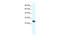 High Mobility Group Box 1 antibody, 28-325, ProSci, Western Blot image 