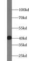 Testis Specific Protein Y-Linked 3 antibody, FNab09067, FineTest, Western Blot image 