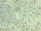 Pyrroline-5-Carboxylate Reductase 1 antibody, LS-C318677, Lifespan Biosciences, Immunohistochemistry paraffin image 