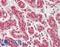 Ras Related GTP Binding D antibody, LS-B14208, Lifespan Biosciences, Immunohistochemistry paraffin image 