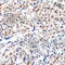 Cyclin Dependent Kinase Inhibitor 1B antibody, AP0328, ABclonal Technology, Immunohistochemistry paraffin image 