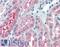OCRL Inositol Polyphosphate-5-Phosphatase antibody, LS-B6106, Lifespan Biosciences, Immunohistochemistry frozen image 