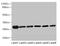 Transmembrane P24 Trafficking Protein 9 antibody, LS-B13000, Lifespan Biosciences, Western Blot image 