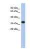 Major Histocompatibility Complex, Class II, DP Alpha 1 antibody, NBP1-59051, Novus Biologicals, Western Blot image 