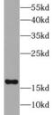 Ubiquitin-conjugating enzyme E2 C antibody, FNab09165, FineTest, Western Blot image 