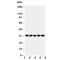 Oxidized Low Density Lipoprotein Receptor 1 antibody, R30930, NSJ Bioreagents, Western Blot image 