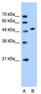 Solute Carrier Family 30 Member 1 antibody, TA333727, Origene, Western Blot image 