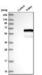 Thyroid Hormone Receptor Alpha antibody, NBP1-90118, Novus Biologicals, Western Blot image 
