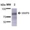 Matrix Metallopeptidase 9 antibody, 29022, QED Bioscience, Western Blot image 