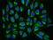 Translocase Of Inner Mitochondrial Membrane 17B antibody, 203323-T02, Sino Biological, Immunohistochemistry frozen image 