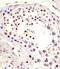 Lin-28 Homolog B antibody, 58-047, ProSci, Immunohistochemistry frozen image 