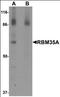 Epithelial Splicing Regulatory Protein 1 antibody, orb95596, Biorbyt, Western Blot image 