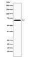 KH RNA Binding Domain Containing, Signal Transduction Associated 1 antibody, M01717-1, Boster Biological Technology, Western Blot image 