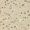 SATB Homeobox 1 antibody, LS-C334301, Lifespan Biosciences, Immunohistochemistry paraffin image 