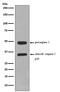 Caspase 2 antibody, M02384-1, Boster Biological Technology, Western Blot image 