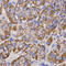 Decorin antibody, A01339, Boster Biological Technology, Immunohistochemistry paraffin image 