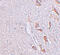 Leucine Rich Repeat Transmembrane Neuronal 1 antibody, 6167, ProSci, Immunohistochemistry paraffin image 