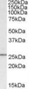 SYF2 Pre-MRNA Splicing Factor antibody, NB100-1132, Novus Biologicals, Western Blot image 