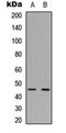 Glycogen Synthase Kinase 3 Beta antibody, orb256575, Biorbyt, Western Blot image 