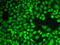 Cathepsin D antibody, 14-893, ProSci, Immunofluorescence image 