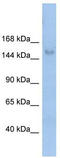 Mov10 Like RISC Complex RNA Helicase 1 antibody, TA341608, Origene, Western Blot image 