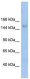 Mov10 Like RISC Complex RNA Helicase 1 antibody, TA341608, Origene, Western Blot image 