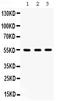 Integrin Linked Kinase antibody, PB9949, Boster Biological Technology, Western Blot image 