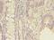 Sodium Channel Epithelial 1 Gamma Subunit antibody, LS-C376555, Lifespan Biosciences, Immunohistochemistry frozen image 