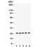 RAB18, Member RAS Oncogene Family antibody, R32328, NSJ Bioreagents, Western Blot image 