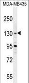 BRD4 Interacting Chromatin Remodeling Complex Associated Protein antibody, LS-C166522, Lifespan Biosciences, Western Blot image 