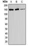 Ataxin 2 antibody, LS-C352811, Lifespan Biosciences, Western Blot image 