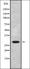 Eukaryotic Translation Initiation Factor 3 Subunit J antibody, orb338305, Biorbyt, Western Blot image 