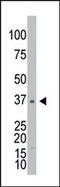 Galactokinase 1 antibody, AP13661PU-N, Origene, Western Blot image 