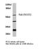 Fyn Related Src Family Tyrosine Kinase antibody, LS-C176763, Lifespan Biosciences, Western Blot image 