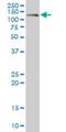 Cadherin 17 antibody, H00001015-M01, Novus Biologicals, Western Blot image 