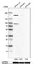 Rho Guanine Nucleotide Exchange Factor 7 antibody, NBP1-88650, Novus Biologicals, Western Blot image 