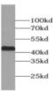 Actin Alpha 2, Smooth Muscle antibody, FNab08038, FineTest, Western Blot image 