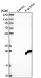 Actin Binding Transcription Modulator antibody, NBP2-38273, Novus Biologicals, Western Blot image 