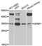 Secreted Frizzled Related Protein 1 antibody, STJ25503, St John