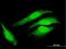COP9 Signalosome Subunit 8 antibody, H00010920-B01P, Novus Biologicals, Immunocytochemistry image 