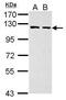 Phosphoribosylglycinamide Formyltransferase, Phosphoribosylglycinamide Synthetase, Phosphoribosylaminoimidazole Synthetase antibody, PA5-30039, Invitrogen Antibodies, Western Blot image 