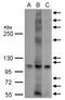 G Protein-Coupled Estrogen Receptor 1 antibody, GTX100001, GeneTex, Western Blot image 