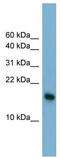 Basic Leucine Zipper ATF-Like Transcription Factor 3 antibody, TA345258, Origene, Western Blot image 