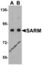 Sterile Alpha And TIR Motif Containing 1 antibody, 3295, ProSci, Western Blot image 