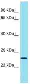 Cancer/Testis Antigen 55 antibody, TA335533, Origene, Western Blot image 