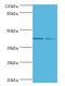 GTF2H2 Family Member C, Copy 2 antibody, LS-C377894, Lifespan Biosciences, Western Blot image 