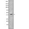 Pygopus Family PHD Finger 2 antibody, abx218091, Abbexa, Western Blot image 